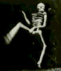 Skeleton of Joy